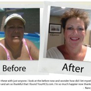 your-hcg-before-after_nancy your-hcg-before-after_nancy